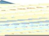 - Hurtel Clear View Case cover