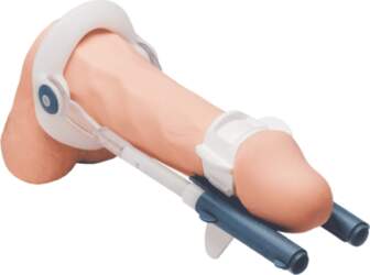 Male Edge Basic Extender System -