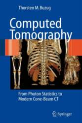 Computed Tomography: From Photon Statistics to