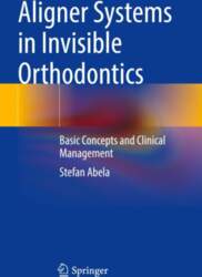 Aligner Systems in Invisible Orthodontics: Basic