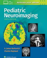 Pediatric Neuroimaging