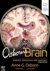 Osborn`s Brain