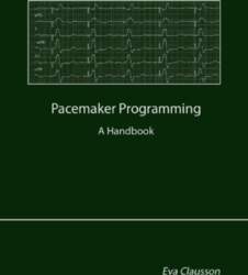 Pacemaker Programming: A Handbook