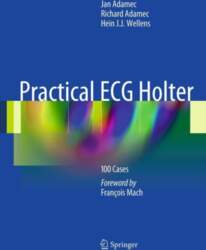 Practical ECG Holter: 100 Cases
