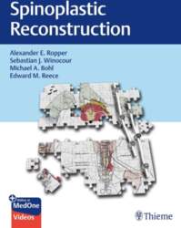 Spinoplastic Reconstruction