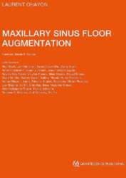 Maxillary Sinus Floor Augmentation