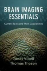 Brain Imaging Essentials: Current Tools and