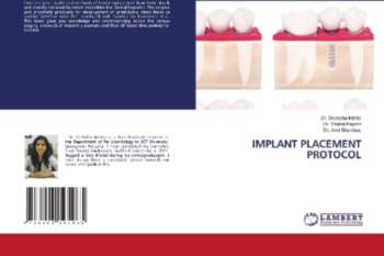 IMPLANT PLACEMENT PROTOCOL
