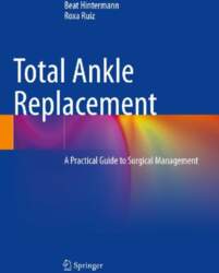 Total Ankle Replacement: A Practical Guide