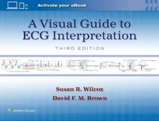 A Visual Guide to ECG Interpretation: