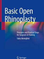 Basic Open Rhinoplasty: Principles and Practical