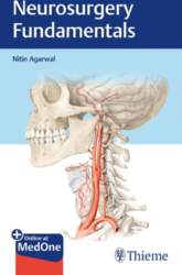 Neurosurgery Fundamentals